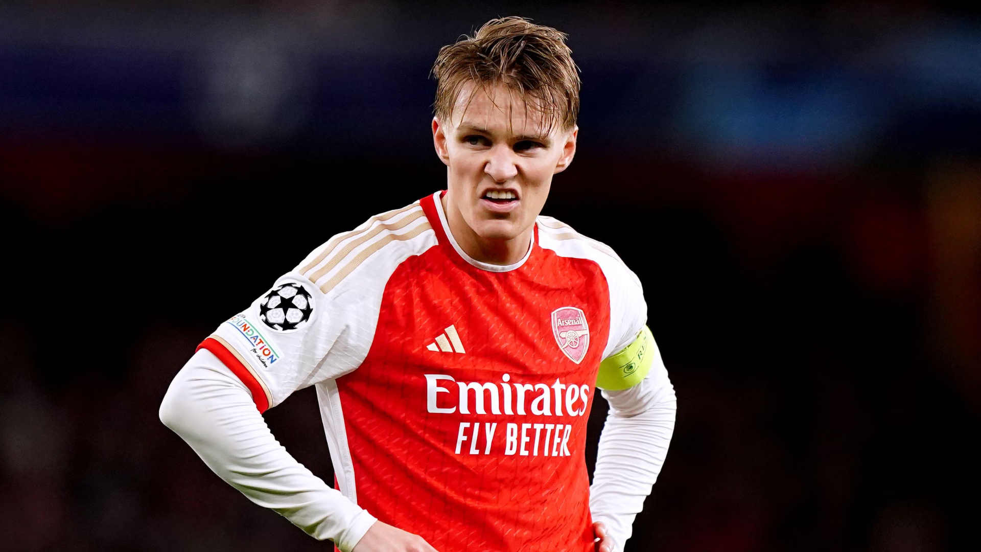 Matin Odeagaard is Extremely Overrated